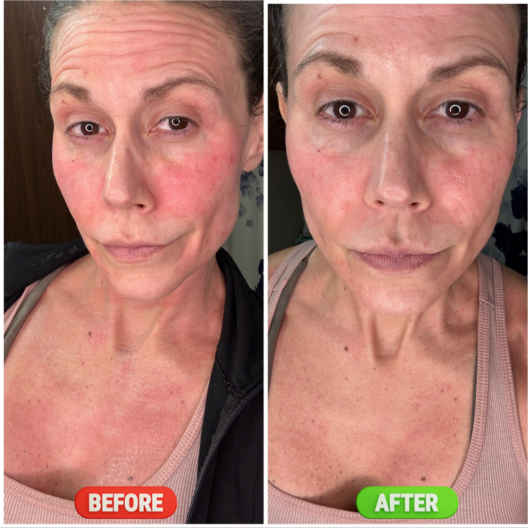 Face Biocellulose Mask