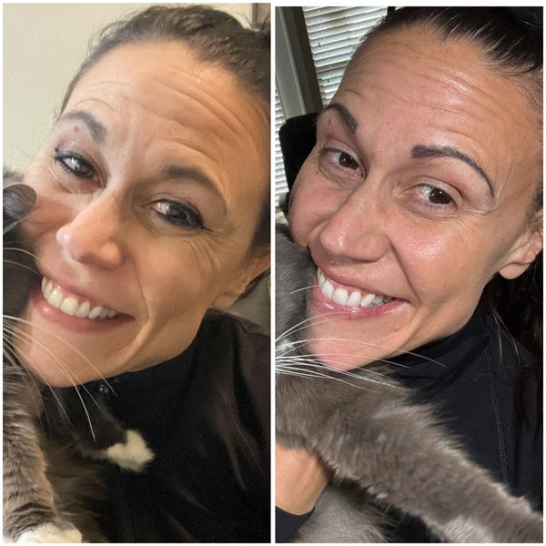 Face before and after